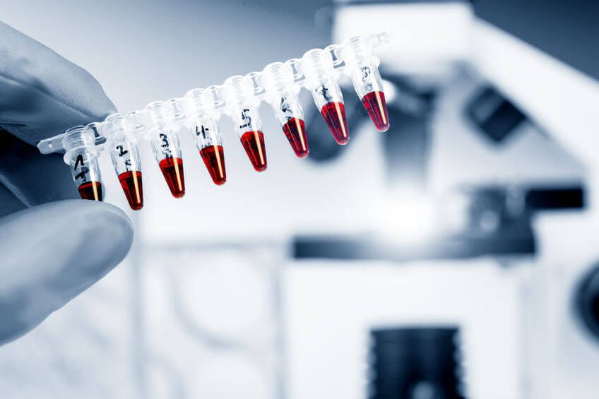 DNA test blood samples.